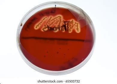 Closeup Double Zone Hemolysis Staphylococcus Aureus Stock Photo ...