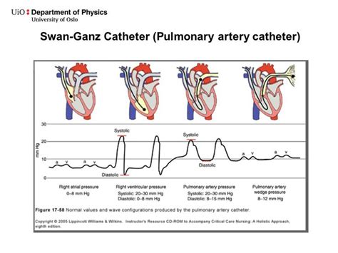 Pa Cath Waveforms Physics Department Heart Catheterization Normal