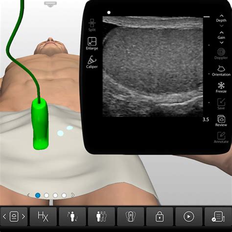 Scrotum Anatomy - Scrotum Ultrasound