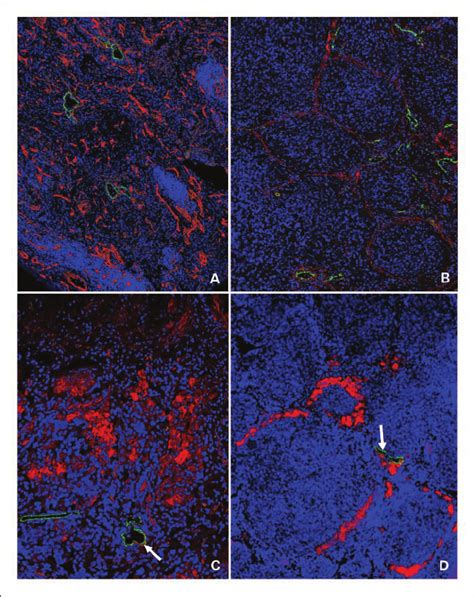 Distribution Of Lymphatic Capillaries And Examples Of Immunostaining