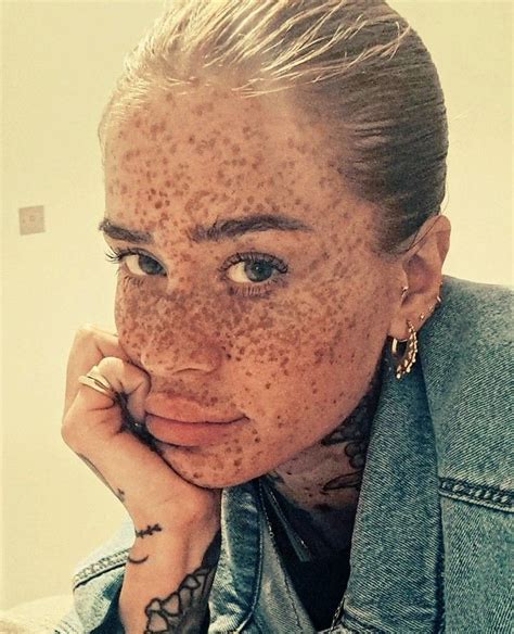 Пин на доске Freckles Perfection