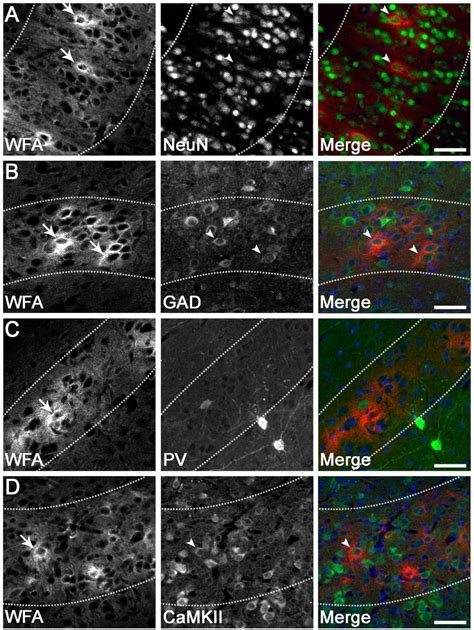 Pnn Expression On Various Neuronal Subtypes In The Parasagittal Cortex