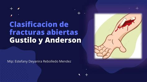 Clasificación de fracturas expuestas Gustillo y Anderson ESTEFANY