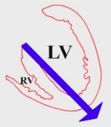 EKG Exam 1 Basic Concepts Of EKGs Flashcards Quizlet