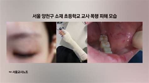 사회 교사 폭행 초등 6학년 전학 결정최고수위 처분 Ytn