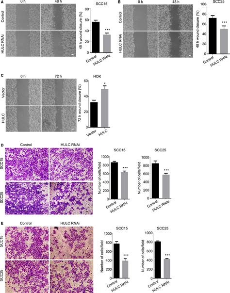 Down‐regulation Of Hulc Inhibits Oscc Cell Migration And Invasion A