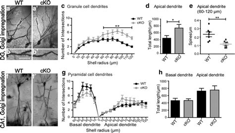 Increased Dendritic Complexity Increased Length And Reduced Spine