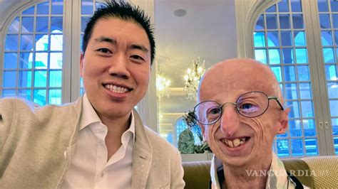 Progeria Una Enfermedad Rara Que Hace Que Los Niños Envejezcan Rápido