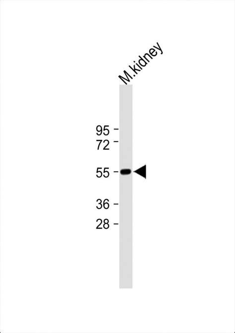 SET07 Antibody Purified Mouse Monoclonal Antibody Mab WB E Buy Now