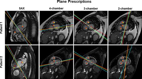 Cardiac Mri Conference 2024 - Carin Cosetta