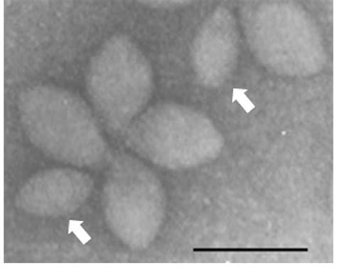Electron microscopy image of SSV2 and pSSVi viral particles. White ...