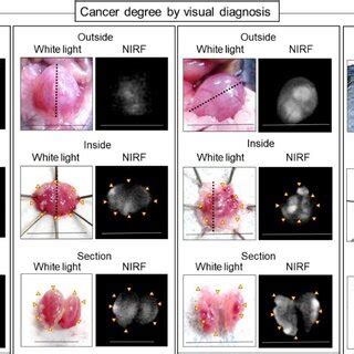 Representative Near Infrared Fluorescence Nirf Imaging Of Mb