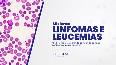 Detecção das Mutações no Gene FLT3 em Leucemia Mielóide Aguda LMA