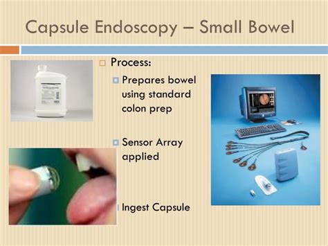 Ppt Capsule Endoscopy Powerpoint Presentation Id4521276