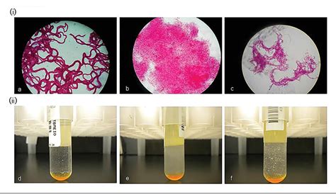 Figure From Growth Characteristics Of Liquid Cultures Increase The