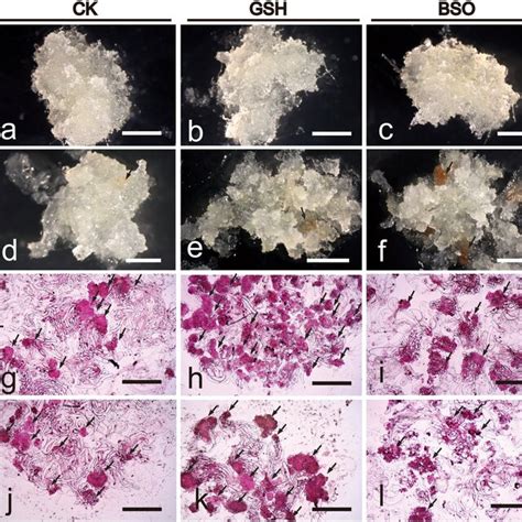 Effects Of Exogenous GSH And BSO On EC Cell Morphology Of Two Korean