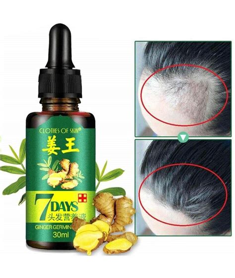 Ginger Germinal Oil Hair Serum In 2022 Essential Oils Hair Care