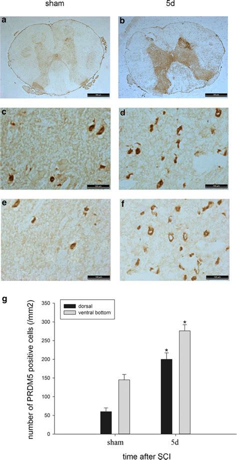 Immunohistochemical Expression Of PRDM5 In Adult Rat Spinal Cord 2 Mm