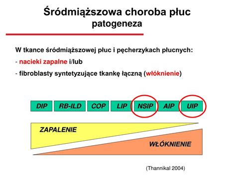 PPT Śródmiąższowa choroba płuc w przebiegu układowych chorób tkanki