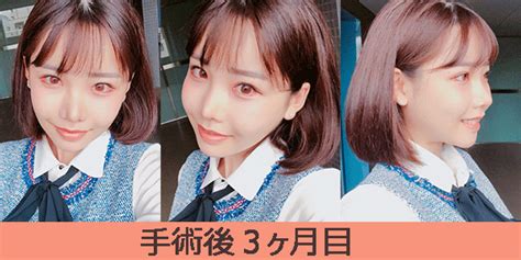 【画像30連発】深田えいみの整形前がヤバすぎワロタww豊胸は確定で昔よりも超絶美人になる秘訣とは？ トレトピマガジン