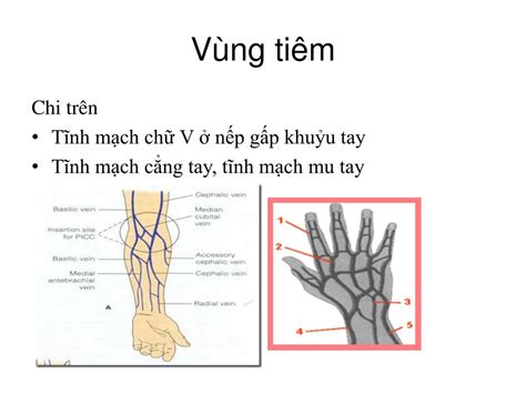 Cách xử lý tai biến khi tiêm tĩnh mạch