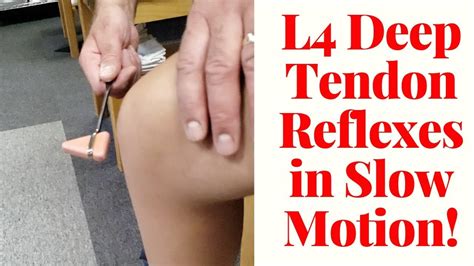 Where To Check Deep Tendon Reflexes