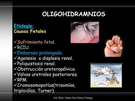 Polihidramnios Oligohidramnios Ppt