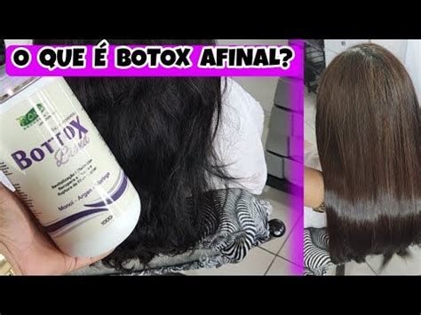 O Que Botox Afinal Youtube