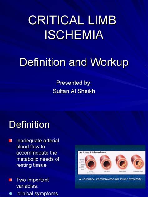 Critical Limb Ischemia | PDF | Ischemia | Angiography