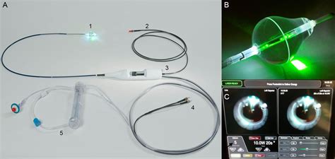 Initial Experience With A New Ablation Catheter Using Laser Energy For