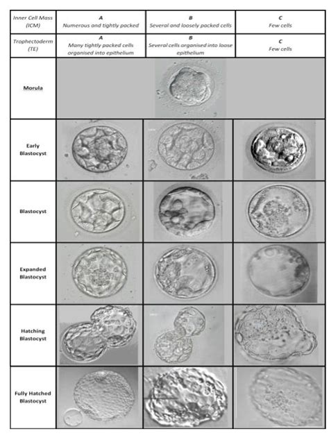 Embryo Grading - Davies Chicago Fertility Specialists Clinic | IVF In ...