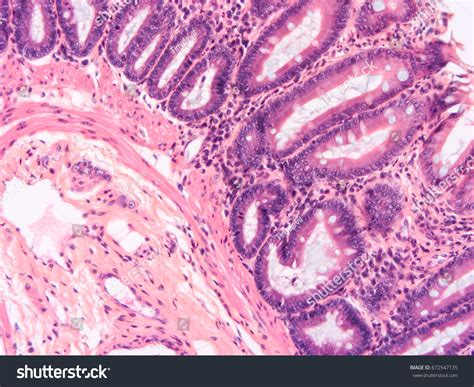 Histology Colon Human Tissue Show Epithelium Shutterstock