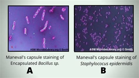 Capsule Staining Procedure Principle Result Biology Notes Online