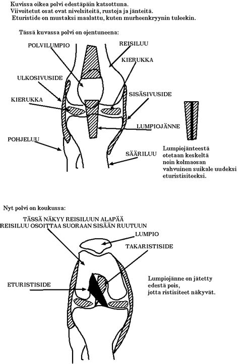 Tietoisku eturistisiteestä