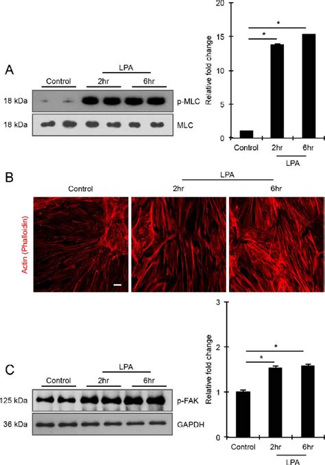 Lpa Induces Formation Of Actin Stress Fibers And Phosphorylation Of Mlc