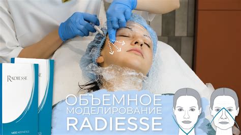 Векторный лифтинг лица | Используем Radiesse как волюмайзер и армирант ...