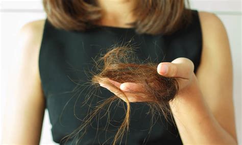 Alopecias Entenda A Doen A Por Tr S Da Perda De Cabelo Pr Sa De