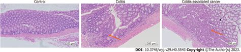 Histological examination of the control, colitis and colitis-associated ...