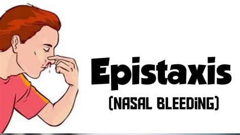 What Is Epistaxis Its Types Causes Signs And Symptoms Treatment