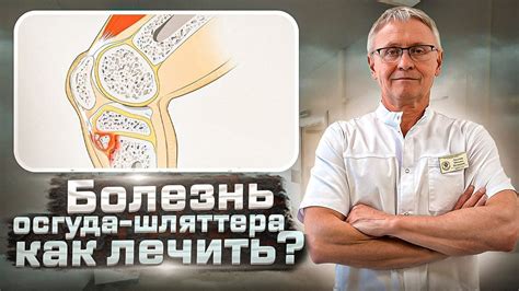 Болит колено, БОЛЕЗНЬ Осгуда-Шляттера | Как лечить колено - YouTube
