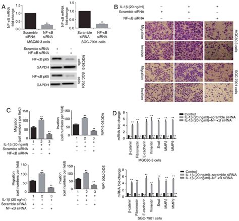 Melatonin Inhibits Epithelialtomesenchymal Transition In Gastric