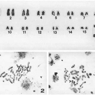 Karyotype Of Male Fig 2 Mitotic Metaphase Cell With C Banding