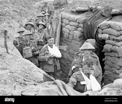 The Hundred Days Offensive August November 1918 Stock Photo Alamy