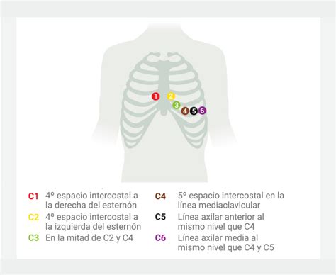 Cómo realizar un ECG MESI Simplifying Diagnostics