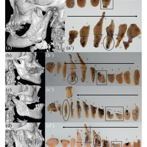 Lateral Three Dimensional Volume Rendering Computed Tomography Images