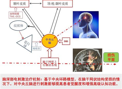 因人而异的选择昏迷促醒的方法 知乎