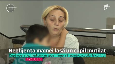 Neglijența mamei lasă un copil mutilat Femeia nu și a dus fiul la