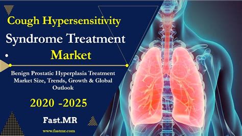 Cough Hypersensitivity Syndrome Treatment Market 2020 Growth Size