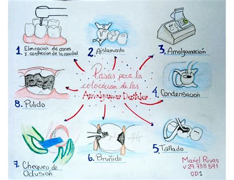 Pasos para Colocación de Amalgamas Dentales Mariel Rivas uDocz