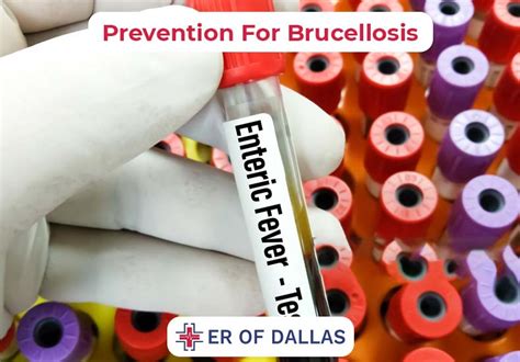 Brucellosis: Causes, Symptoms, and Treatment Options - ER of Dallas